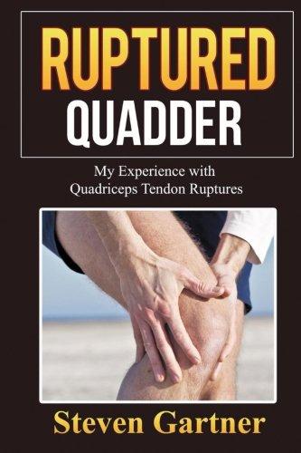 Ruptured Quadder: My Experience with Bilateral Quadriceps Tendon Rupture