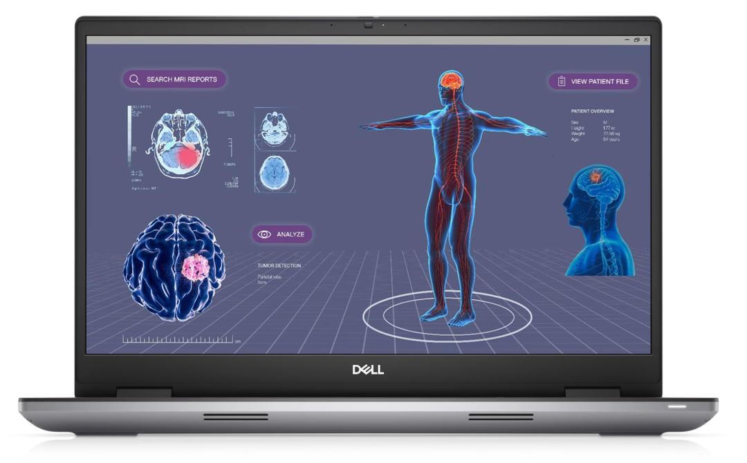 Dell Precision 7780 17" Mobile Workstation Intel Core i7-13850HX (20-Core) 512GB SSD 32GB RAM FHD (1920x1200) 500-Nit IPS RTX A1000 6GB Windows 11 Pro (Renewed)