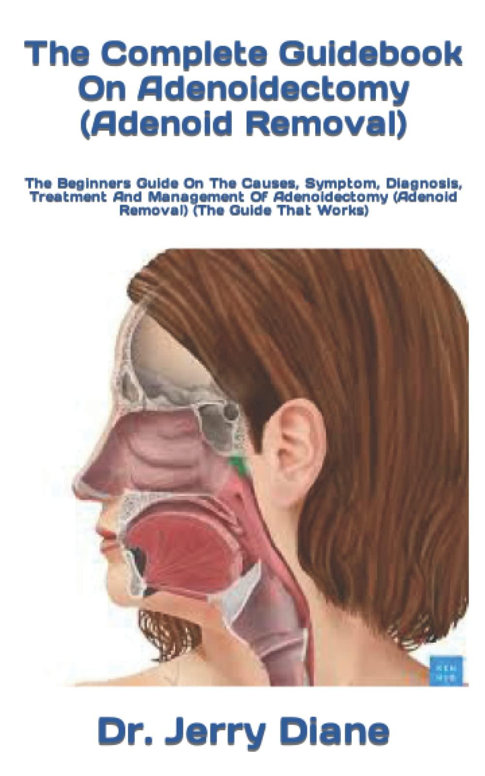 The Complete Guidebook On Adenoidectomy (Adenoid Removal): The Beginners Guide On The Causes, Symptom, Diagnosis, Treatment And Management Of Adenoidectomy (Adenoid Removal) (The Guide That Works)